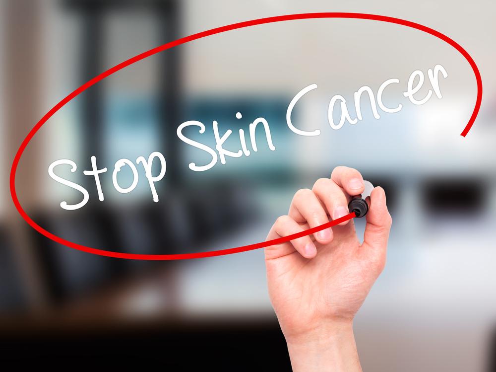 Most Common and Rare Varieties of Skin Cancer