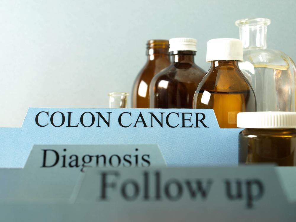 Symptoms and Risk Factors of Colon Cancer