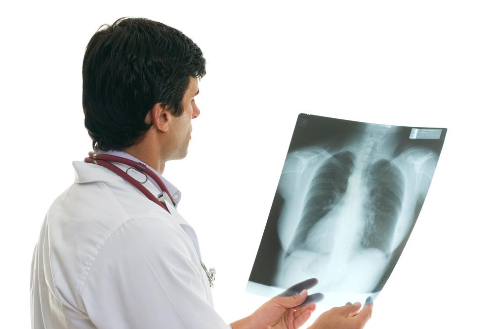 Things to Know About Non-Small Cell Lung Cancer Treatments