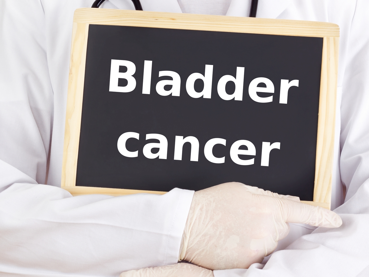 Treatments Options for Bladder Cancer